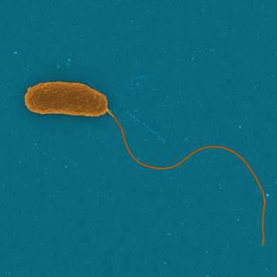 The marine bacterium under the scanning electron microscope