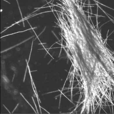 Cyanobakterium Trichodesmium