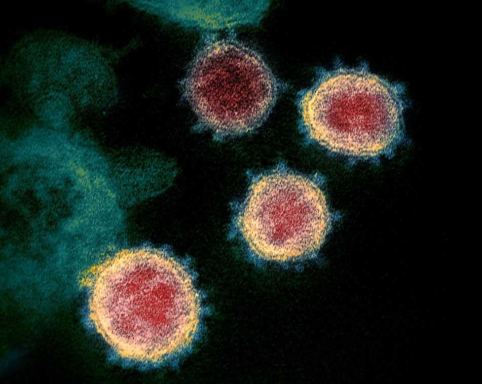Novel Coronavirus SARS-CoV-2 by NIAID-RML