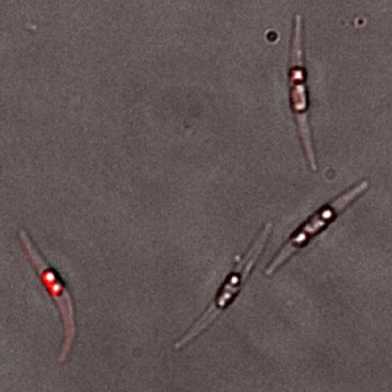 mikroskopische Ansicht des Phytoplanktons